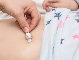 Enternal Feed Management 1