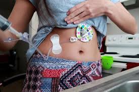 Enternal Feed Management 2