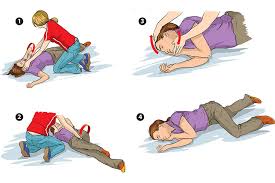 Seizure Management 1