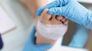 Wound Management - 1